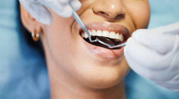 Professional  Dental Services in Punta Rassa, FL